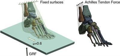 Cartilage Stiffness Effect on Foot Biomechanics of Chinese Bound Foot: A Finite Element Analysis